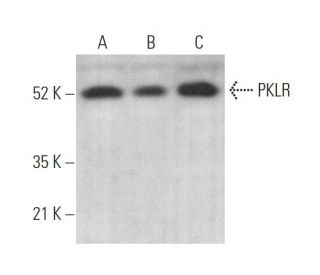 PKLR Antibody (G-11) - Western Blotting - Image 375079 
