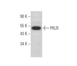 PKLR Antibody (E-2) - Western Blotting - Image 372581