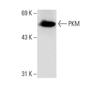 PKM Antibody (YY-3) - Western Blotting - Image 62731 