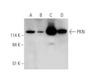 western blotting image from recommended PKN (H-4) monoclonal antibody replacement. Image 345956