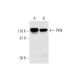 PKN Antibody (H-4) - Western Blotting - Image 294798