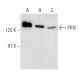 PKN Antibody (H-4) - Western Blotting - Image 358473 
