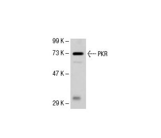 PKR Antibody (FJ-6) - Western Blotting - Image 49348 