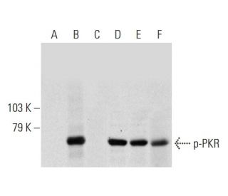 western blotting image from recommended PKR (B-10) monoclonal antibody replacement. Image 145566