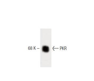 PKR Antibody (13) - Western Blotting - Image 60413 