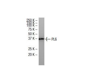 PL6 Antibody (38-K) - Western Blotting - Image 34021 