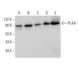 PLAA Antibody (E-1) - Western Blotting - Image 377072Each CRISPR/Cas9 Knockout (KO) Plasmid product consists of a pool of 3 plasmids designed to ensure identification and cleavage of a specific gene for maximum knockout efficiency. Each plasmid encodes a unique 20 nt sequence derived from the GeCKO (v2) library.