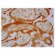 PLAC1 Antibody (G-1) - Immunohistochemistry - Image 350202 