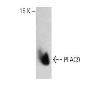 PLAC9 Antibody (F7) - Western Blotting - Image 374565Each CRISPR/Cas9 Knockout (KO) Plasmid product consists of a pool of 3 plasmids designed to ensure identification and cleavage of a specific gene for maximum knockout efficiency. Each plasmid encodes a unique 20 nt sequence derived from the GeCKO (v2) library.