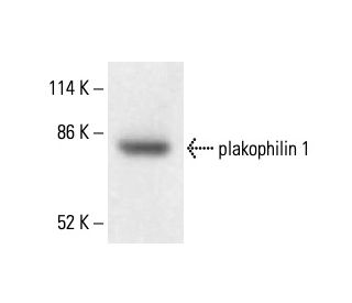 plakophilin 1 Antibody (3G250) - Western Blotting - Image 411906