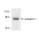 plakophilin 1 Antibody (3G250) - Western Blotting - Image 411906