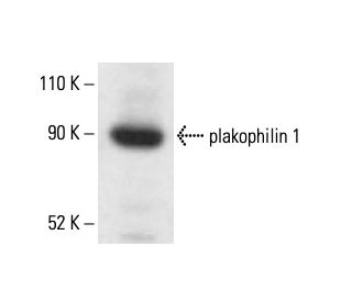plakophilin 1 Antibody (3G250) - Western Blotting - Image 411905