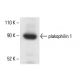 plakophilin 1 Antibody (3G250) - Western Blotting - Image 411905