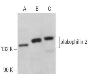 plakophilin 2 Antibody (C-1) - Western Blotting - Image 359060The Double Nickase Plasmid features a U6 promoter for sgRNA expression, a 20 nt targeting sequence, and a gRNA scaffold to guide Cas9n. It includes a CBh promoter for Cas9n (D10A) and puromycin resistance, GFP for transfection verification, and nuclear localization signals (NLS). The 2A peptide allows co-expression of Cas9n and Puro from a single promoter, enabling precise genome editing with reduced off-target effects. 