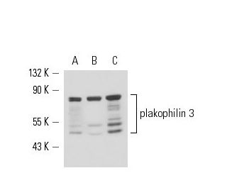 plakophilin 3 Antibody (23E3/4) - Western Blotting - Image 15778 