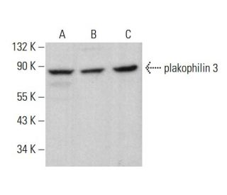 plakophilin 3 Antibody (E-10) - Western Blotting - Image 382140 