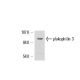 plakophilin 3 Antibody (E612B11F8) - Western Blotting - Image 17295 