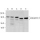 plakophilin 3 Antibody (H-8) - Western Blotting - Image 364844 