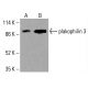 Plakophilin 3 Anticorpo (H-8): sc-515774. Analisi Western blot dell'espressione di plakophilin 3 in lisati cellulari totali di K-562 (A) e HCT-116 (B). Reagente di rivelazione utilizzato: m-IgG Fc BP-HRP: sc-525409. plakophilin 3 Antibody (H-8) - Western Blotting - Image 416101