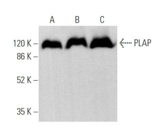 PLAP Antibody (8B6) - Western Blotting - Image 373920 