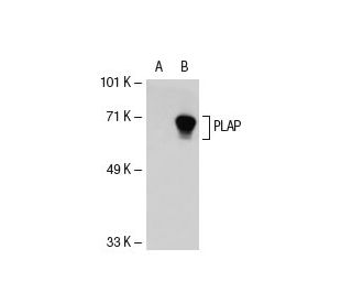 PLAP Antibody (HD 11F7) - Western Blotting - Image 21654