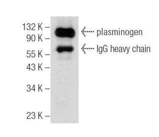 plasminogen Antibody (E-14): sc-15036