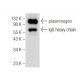 This polyclonal antibody has been discontinued. See our recommended <a href="plasminogen-antibody-g-7">plasminogen (G-7)</a> monoclonal antibody (sample data shown). western blotting image from recommended plasminogen (G-7) monoclonal antibody replacement. Image 155535
