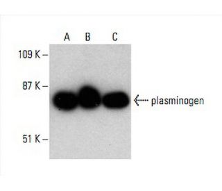 western blotting image from recommended plasminogen (B-11) monoclonal antibody replacement. Image 392567