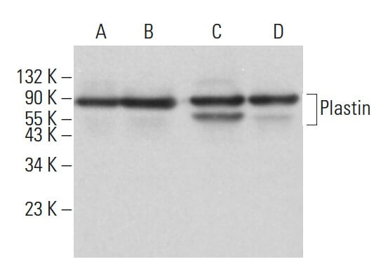 Plastin Antibody (F-2) | SCBT - Santa Cruz Biotechnology