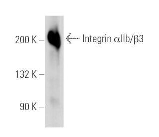 Platelet IIb/IIIa complex Antibody (189/21-10) - Western Blotting - Image 13976