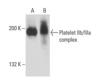 Platelet IIb/IIIa complex Antibody (85/661) - Western Blotting - Image 18165