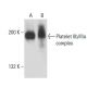 Platelet IIb/IIIa complex Antibody (85/661) - Western Blotting - Image 18165
