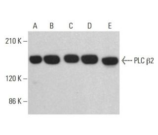 western blotting image from recommended PLC β2 (B-2) monoclonal antibody replacement. Image 382602