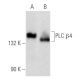 western blotting image from recommended PLC β4 (A-8) monoclonal antibody replacement. Image 355820