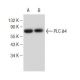 PLC δ4 Antibody (B-2) - Western Blotting - Image 146822 