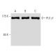 PLC γ1 Antibody (1F1) - Western Blotting - Image 62867