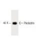Pleckstrin Antibody (25) - Western Blotting - Image 60417