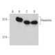 Pleckstrin Antibody (25) - Western Blotting - Image 396111 