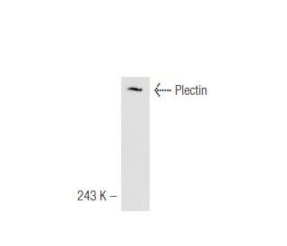 Plectin Antibody (1A2) - Western Blotting - Image 47270 