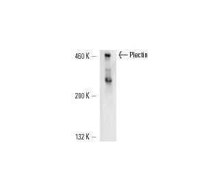 Plectin Antibody (7A8) - Western Blotting - Image 14806 