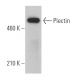 Plectin Antibody (7A8) - Western Blotting - Image 362889