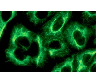 immunofluorescence image from recommended Plectin (10F6) monoclonal antibody replacement. Image 12119