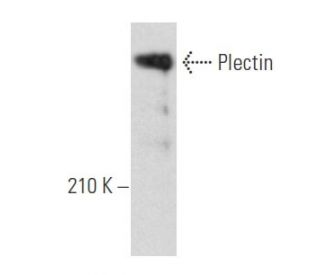 Plectin Antibody (10F6) - Western Blotting - Image 355761The Double Nickase Plasmid features a U6 promoter for sgRNA expression, a 20 nt targeting sequence, and a gRNA scaffold to guide Cas9n. It includes a CBh promoter for Cas9n (D10A) and puromycin resistance, GFP for transfection verification, and nuclear localization signals (NLS). The 2A peptide allows co-expression of Cas9n and Puro from a single promoter, enabling precise genome editing with reduced off-target effects.