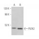 PLEK2 Antibody (E-11) - Western Blotting - Image 374368