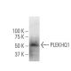 PLEKHQ1 Antibody (SS-23) - Western Blotting - Image 33785