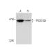 PLEKHQ1 Antibody (SS-23) - Western Blotting - Image 138599 
