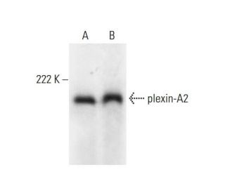 plexin-A2 Antibody (A-2) - Western Blotting - Image 299300