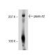 plexin-A2 Antibody (E-1) - Western Blotting - Image 72590