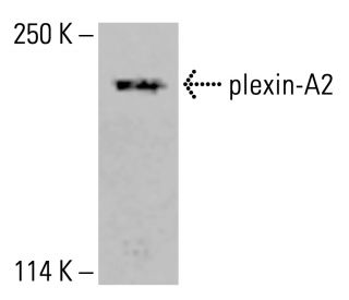 plexin-A2 Antibody (E-1) - Western Blotting - Image 413584 