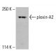 plexin-A2 Antibody (E-1) - Western Blotting - Image 413584 